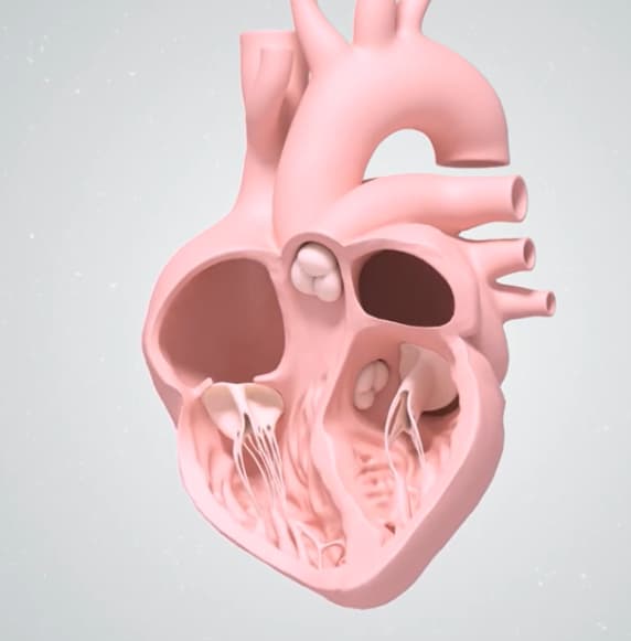 Implantation Image