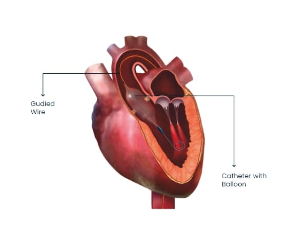 Heart