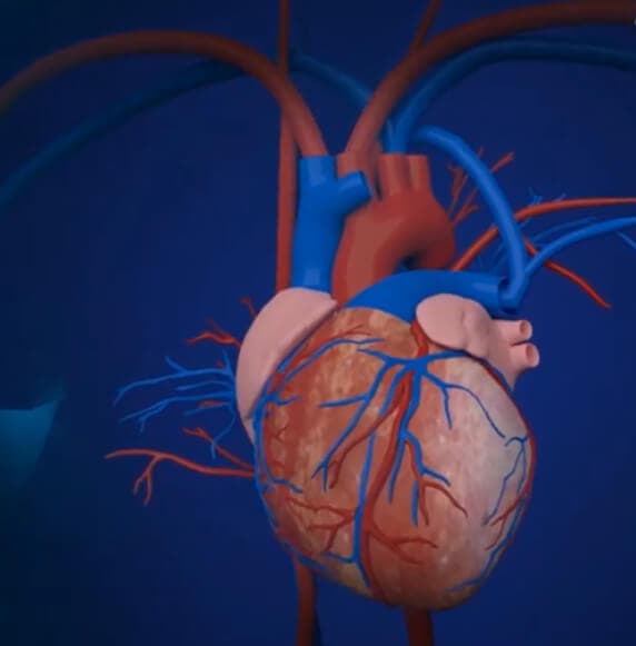 Implantation Image