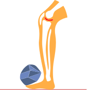 Joint stiffness and soreness